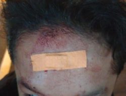 Viral! Diduga Korban Kejahatan Jalanan, Pemuda di Bantul Alami Luka di Dahi
