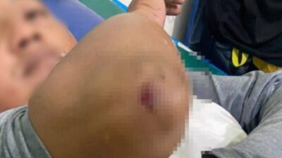 Berniat Lerai Bentrokan, Warga Girisubo Justru Dikeroyok saat Malam Takbiran: Kisah Humanis di Tengah Ketegangan Gunungkidul
